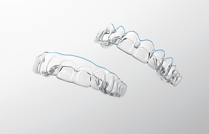 マウスピース矯正